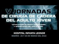 V Jornadas de Cirugía de Cadera del Adulto Joven en el Hospital Infanta Leonor de Madrid